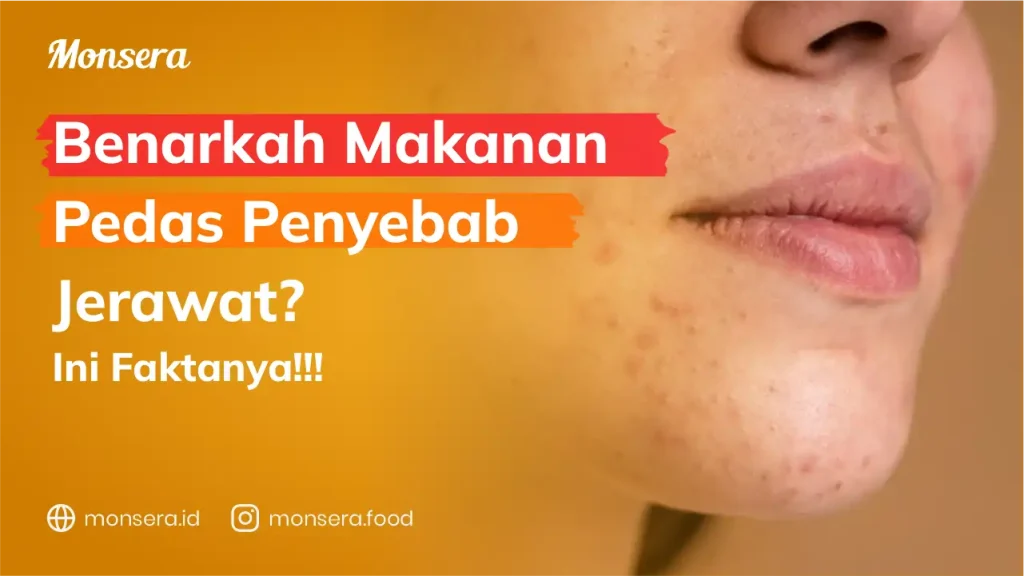Benarkah Makanan Pedas Penyebab Jerawat? Ini Faktanya!!!