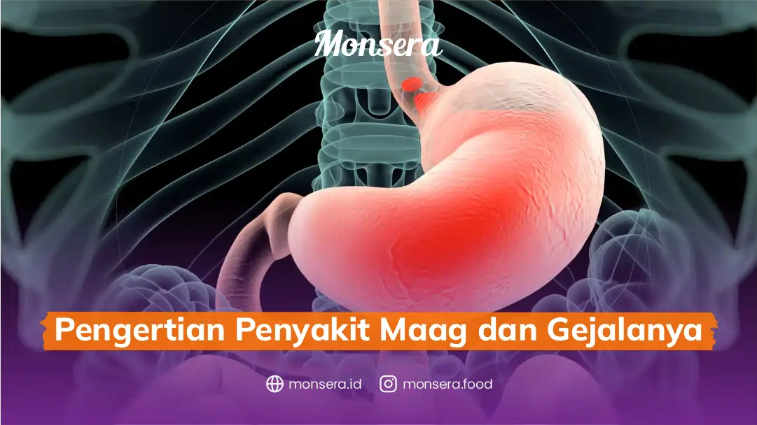 Pengertian Penyakit Maag dan Gejalanya